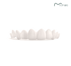 Custom Snap-On Veneers - Single Arch - Natural White