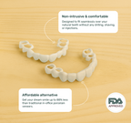 Custom Snap-On Veneers - Single Arch - Natural White