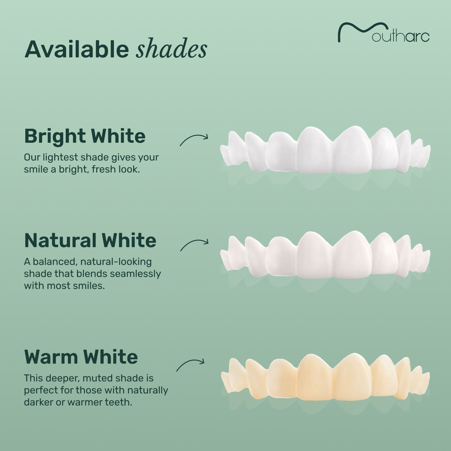 Custom Snap-On Veneers - Single Arch - Natural White