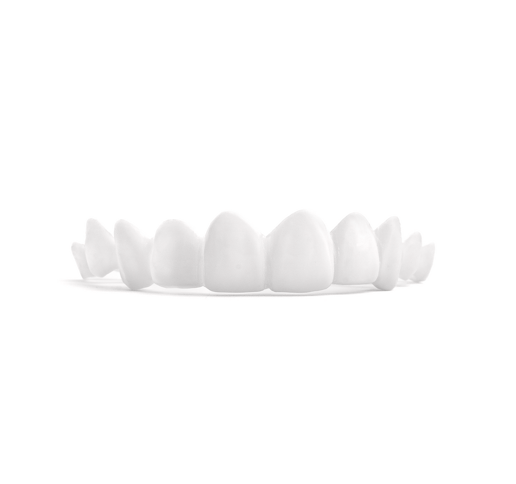 Custom Snap-On Veneers - Dual Arch - Bright White