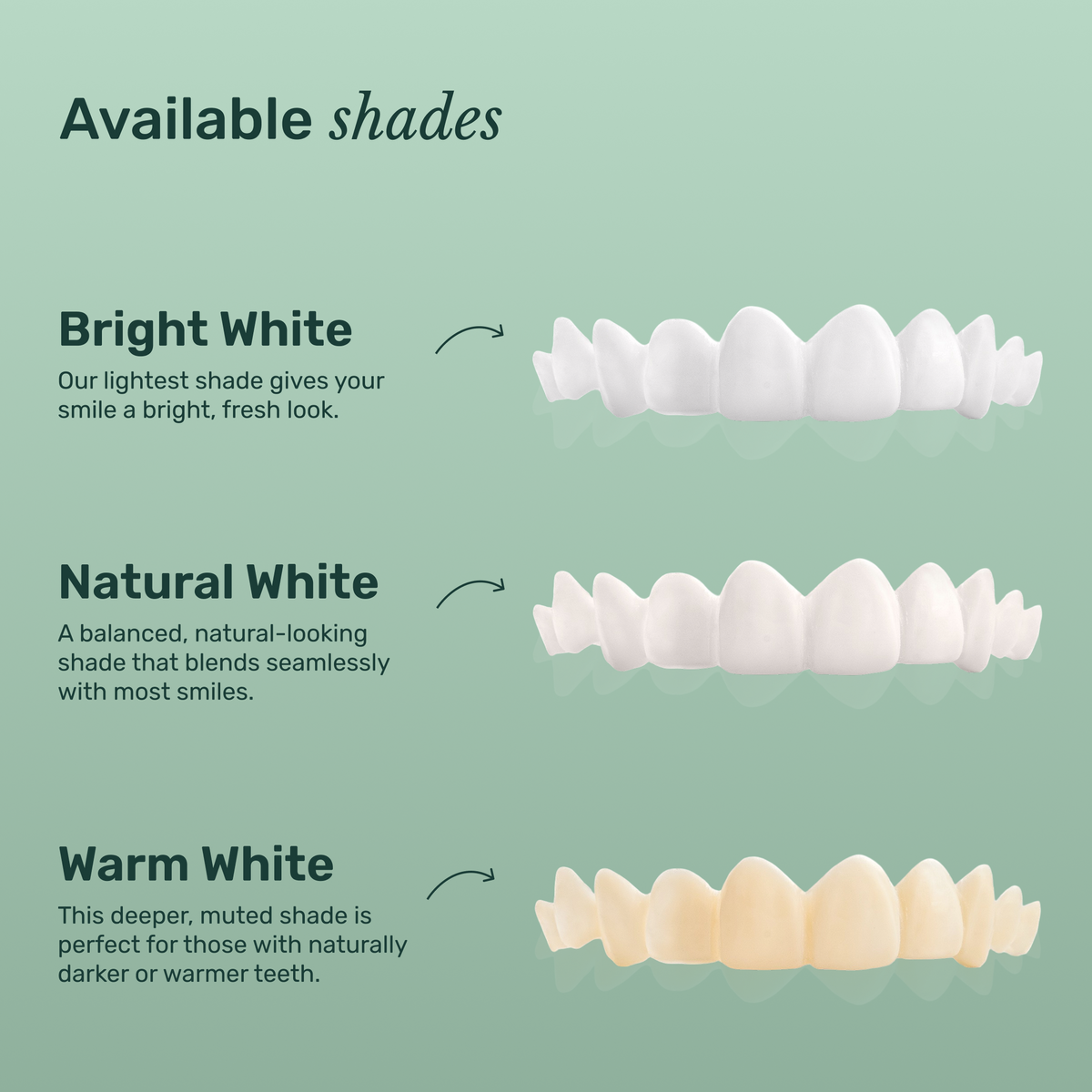 Custom Snap-On Veneers - Dual Arch - Bright White