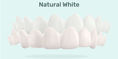 Custom Snap-On Veneers - Dual Arch - Natural White