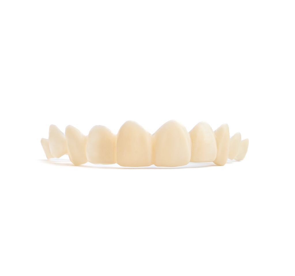 Custom Snap-On Veneers - Single Arch - Warm White