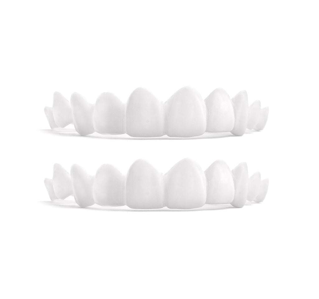 Custom Snap-On Veneers - Dual Arch - Bright White