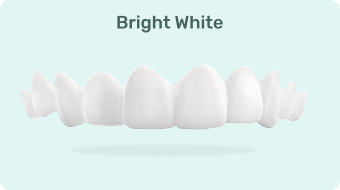 Custom Snap-On Veneers - Single Arch - Bright White