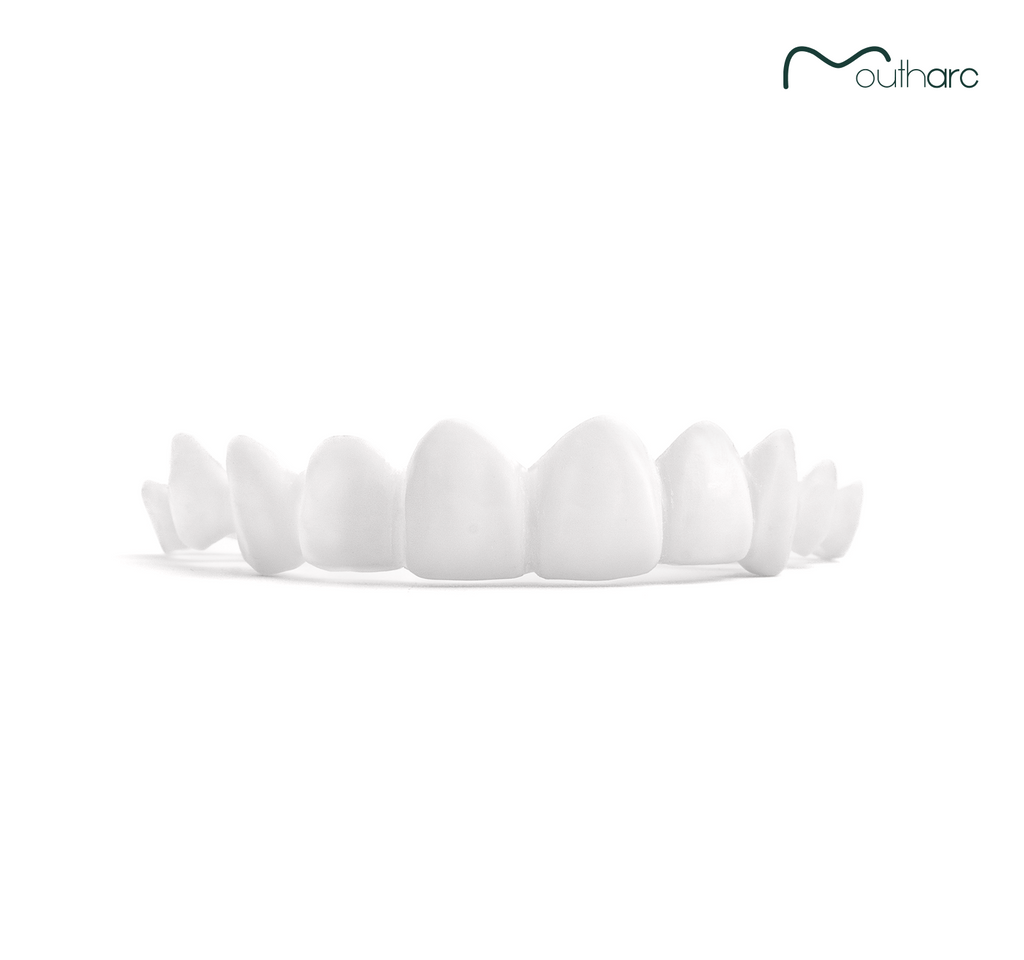 Custom Snap-On Veneers - Single Arch - Bright White