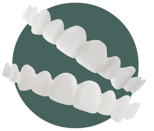 Dual arch veneers example