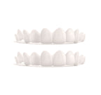Custom Snap-On Veneers - Dual Arch - Natural White