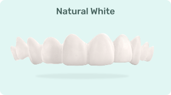 Custom Snap-On Veneers - Single Arch - Natural White