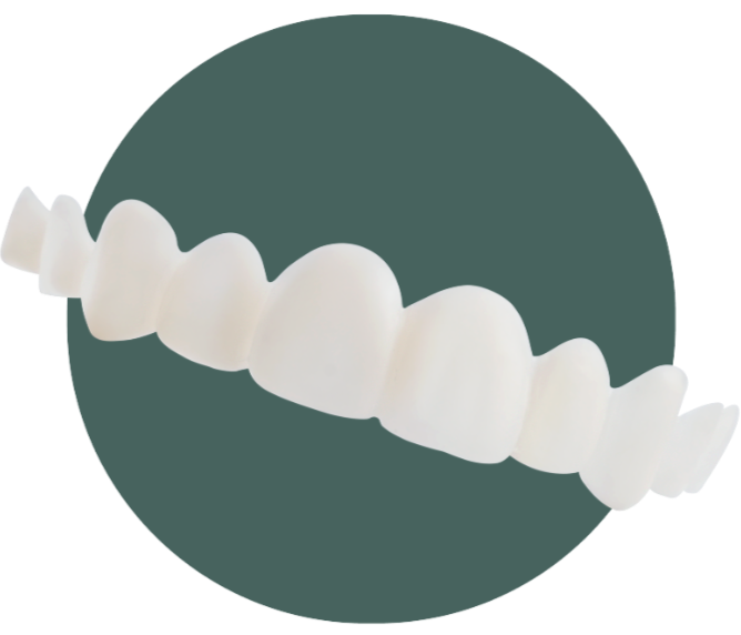 Single arch veneer example