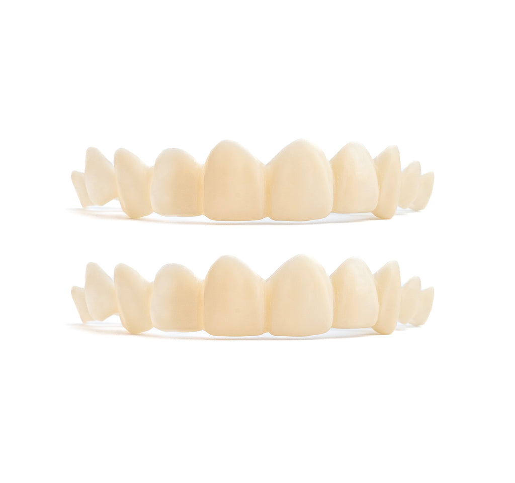 Custom Snap-On Veneers - Dual Arch - Warm White