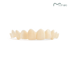 Custom Snap-On Veneers - Dual Arch - Warm White